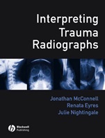 Interpreting Trauma Radiographs - ISBN 9781405115346