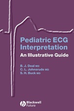Pediatric ECG Interpretation: An Illustrative Guide - ISBN 9781405117302