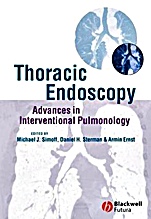 Thoracic Endoscopy: Advances in Interventional Pulmonology - ISBN 9781405122047