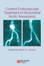 Current Endovascular Treatment of Abdominal Aortic Aneurysms - ISBN 9781405122054