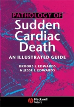 Pathology of Sudden Cardiac Death: An Illustrated Guide - ISBN 9781405122122