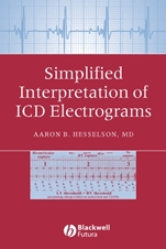 Simplified Interpretation of ICD Electrograms - ISBN 9781405127318