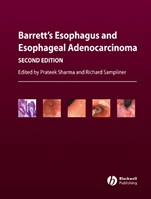 Barretts Esophagus and Esophageal Adenocarcinoma - ISBN 9781405127868