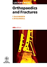 Orthopaedics and Fractures - ISBN 9781405133296