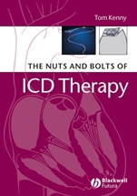 The Nuts and Bolts of ICD Therapy - ISBN 9781405135115