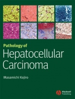 Pathology of Hepatocellular Carcinoma - ISBN 9781405139083