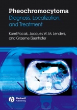 Pheochromocytoma: Diagnosis, Localization, and Treatment - ISBN 9781405149501