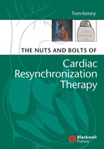 The Nuts and Bolts of Cardiac Resynchronization Therapy - ISBN 9781405153720