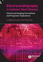 Electrocardiography in Ischemic Heart Disease: Clinical and Imaging Correlations and Prognostic Implications - ISBN 9781405173629
