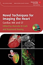 Novel Techniques for Imaging the Heart: Cardiac MR and CT - ISBN 9781405175333