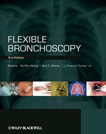 Flexible Bronchoscopy - ISBN 9781405175876