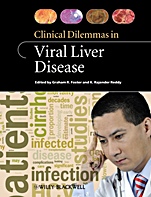Clinical Dilemmas in Viral Liver Disease - ISBN 9781405179058