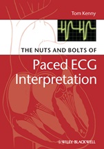 The Nuts and bolts of Paced ECG Interpretation - ISBN 9781405184045