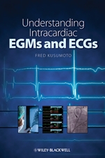 Understanding Intracardiac EGMs and ECGs - ISBN 9781405184106