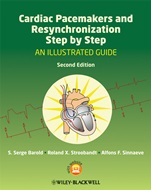 Cardiac Pacemakers and Resynchronization Step by Step: An Illustrated Guide - ISBN 9781405186360