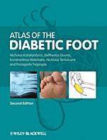 Atlas of the Diabetic Foot - ISBN 9781405191791