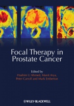 Focal Therapy in Prostate Cancer - ISBN 9781405196499