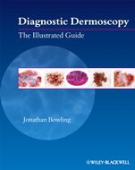 Diagnostic Dermoscopy: The Illustrated Guide - ISBN 9781405198554