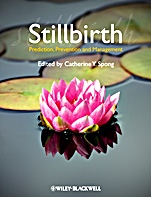 Stillbirth: Prediction, Prevention and Management - ISBN 9781444337068
