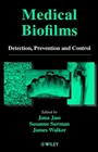 Medical Biofilms: Detection, Prevention and Control - ISBN 9780471988670