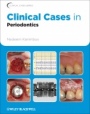 Clinical Cases in Periodontics - ISBN 9780813807942