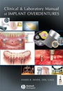 Clinical and Laboratory Manual of Implant Overdentures - ISBN 9780813808819