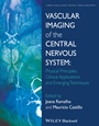 Vascular Imaging of the Central Nervous System: Physical Principles, Clinical Applications, and Emerging Techniques - ISBN 9781118188750