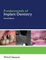 Fundamentals of Implant Dentistry - ISBN 9781118274965