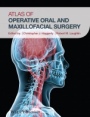 Atlas of Operative Oral and Maxillofacial Surgery - ISBN 9781118442340