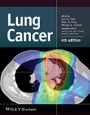Lung Cancer - ISBN 9781118468746