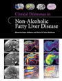 Clinical Dilemmas in Non–Alcoholic Fatty Liver Disease - ISBN 9781118912034
