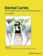 Dental Caries: The Disease and its Clinical Management - ISBN 9781118935828