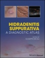 Hidradenitis Suppurativa: A Diagnostic Atlas - ISBN 9781119272953