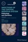 Infections of the Central Nervous System: Pathology and Genetics - ISBN 9781119467762