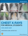 Chest X–Rays for Medical Students: CXRs Made Easy - ISBN 9781119504153