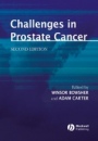 Challenges in Prostate Cancer - ISBN 9781405107525