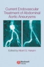 Current Endovascular Treatment of Abdominal Aortic Aneurysms - ISBN 9781405122054