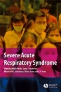 Severe Acute Respiratory Syndrome - ISBN 9781405130318