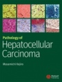 Pathology of Hepatocellular Carcinoma - ISBN 9781405139083