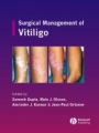 Surgical Management of Vitiligo - ISBN 9781405145213
