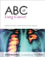 ABC of Lung Cancer - ISBN 9781405146524