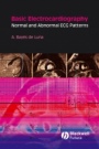 Basic Electrocardiography: Normal and Abnormal ECG Patterns - ISBN 9781405175708