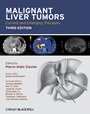 Malignant Liver Tumors: Current and Emerging Therapies - ISBN 9781405179768