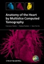 Anatomy of the Heart by Multislice Computed Tomography - ISBN 9781405180559